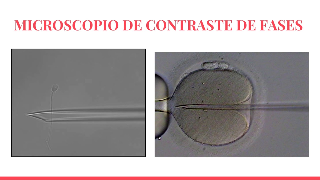 maximos aumentos del microscopio de contraste de fases