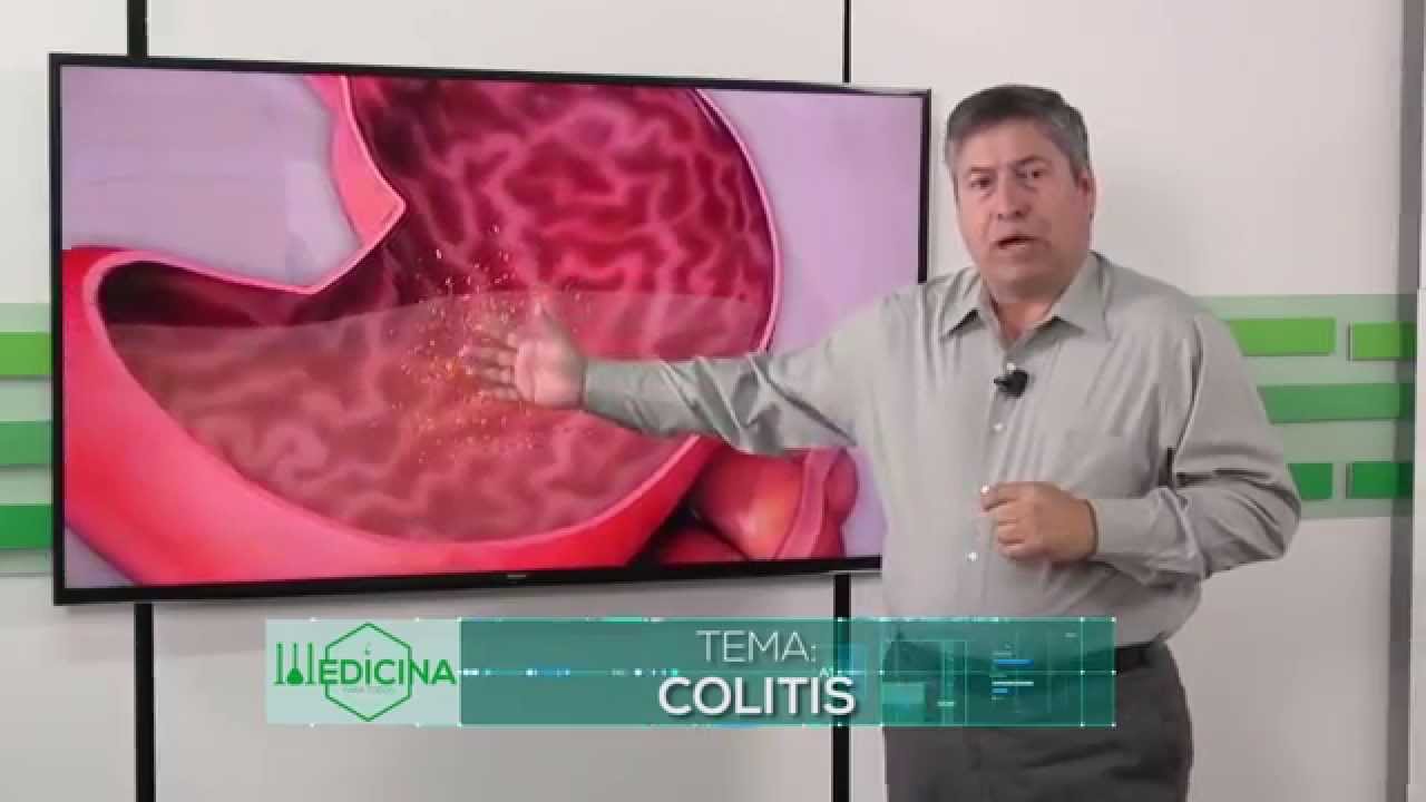 que pastillas son buenas para la colitis nerviosa
