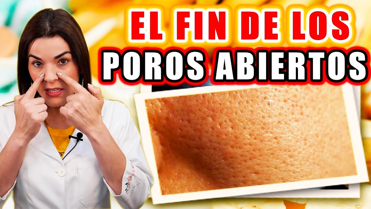 como cerrar los poros de la cara remedios caseros