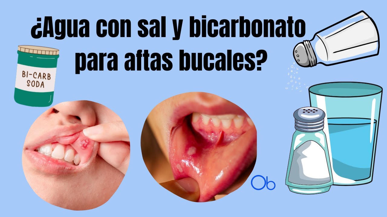 como curar llagas en la boca con bicarbonato