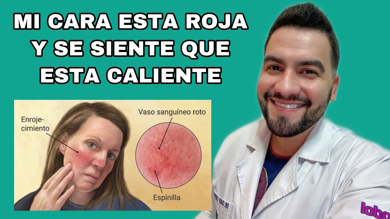 porque las mejillas se ponen rojas y arden